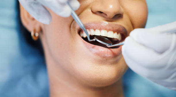 Best Knocked-Out Tooth Emergency  in Lochsloy, WA